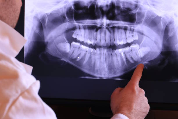 Best Emergency Treatment for Jaw Pain or Injury in Rosedale, WA