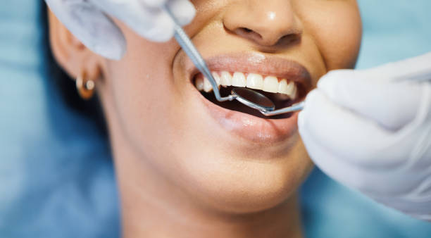 Best Emergency Treatment for Oral Infections in Rosedale, WA